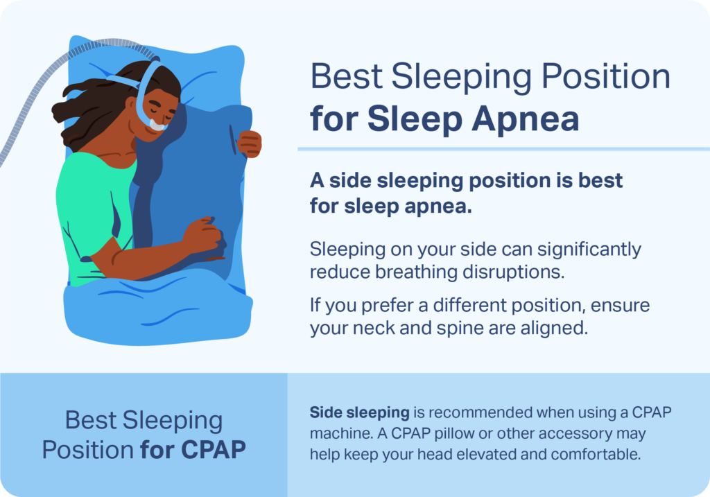 Best Sleeping Position for Sleep Apnea